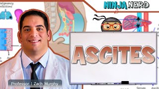 Ascites  Clinical Medicine [upl. by Nur]