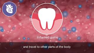 Oral and general health animation [upl. by Jude]