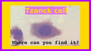 Tzanck cell [upl. by Ahseer86]