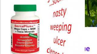 Leg Ulcers Wound Healing Wound Infection amp Serrapeptase  Colliodal Silver [upl. by Nehtan174]