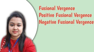 FUSIONAL VERGENCE  POSITIVE AND NEGATIVE FUSIONAL VERGENCE [upl. by Jurdi]