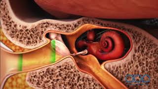 How the Ear Works  3D Medical Animation  ABP © [upl. by Yecam]