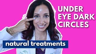 Eye Doctor Explains How To Get Rid Of Dark Under Eye Circles Naturally [upl. by Anitsirhk]