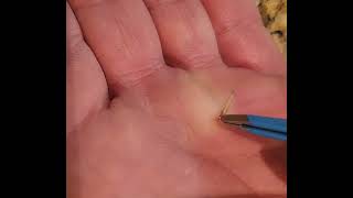 Removing large splinter from my hand [upl. by Ibed871]