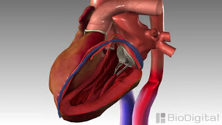 3D Medical Animation  Congestive Heart Failure [upl. by Aubry]