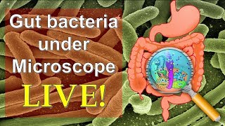 E COLI  Escherichia Coli [upl. by Attiuqram]