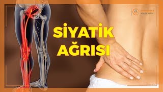 SİYATİK HASTALIĞI [upl. by Nosreme]