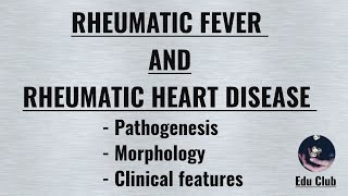 Rheumatic fever and Rheumatic Heart Disease  Pathophysiology  Morphology  Clinical features [upl. by Myrwyn469]