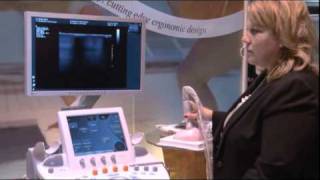 Hologic  Breast Ultrasound MRI and Tomosynthesis [upl. by Fabian]