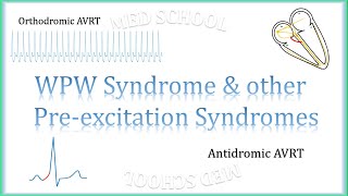 WPW Syndrome amp other preexcitation syndromes [upl. by Nuajed446]