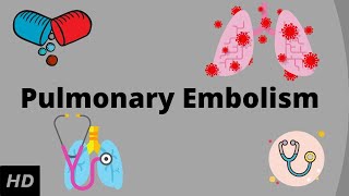 Pulmonary embolism Causes Signs and Symptoms Diagnosis and Treatment [upl. by Nidla]