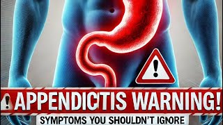 “Appendicitis Warning Signs Don’t Miss These Symptoms” [upl. by Thomasine67]