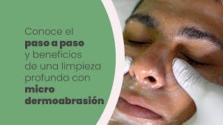 Limpieza facial con microdermoabrasión en hombre de piel joven ¡resultados en su primera sesión [upl. by Eeslehc]