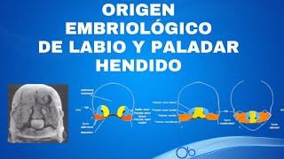 Origen Embriológico de Labio y Paladar Hendido [upl. by Felten]