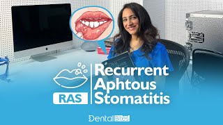 RAS Recurrent Aphthous Stomatitis [upl. by Suoicserp]