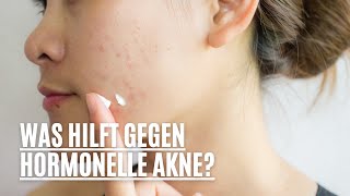 Was hilft gegen hormonelle Akne [upl. by Einavoj]