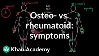 Osteoarthritis vs rheumatoid arthritis symptoms  NCLEXRN  Khan Academy [upl. by Leasim]