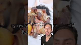 LIVE Snail Facial Would You Try It [upl. by Erikson]