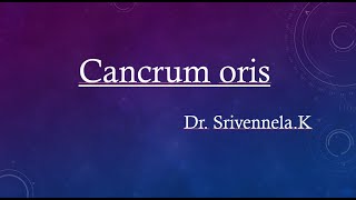 Cancrum oris [upl. by Darelle850]