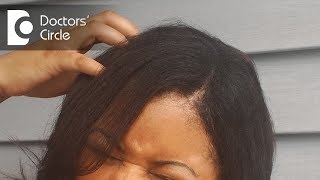 Reasons for itchy scalp and how to treat it  Dr Rasya Dixit [upl. by Swetlana]