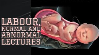 LABOUR lecture 10 POOR progress in 2nd STAGE of labour FETAL COMPROMISE management made easy [upl. by Gildea588]