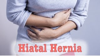 Hiatal Hernia  Cause and Solution [upl. by Fauch]