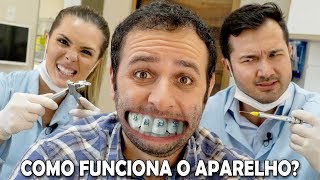 Como o aparelho desentorta os dentes Boravê [upl. by Tavy]