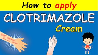 Clotrimazole cream Lotrimin How to apply  Uses and Side effects [upl. by Birck574]