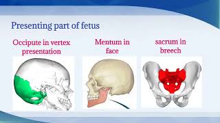 Malposition  Definition Etiology Diagnosis Management of malposition  Easy explanation OBGY Nsg [upl. by Imelda]