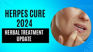 Herpes Cure 2024  Herbal Treatment Update [upl. by Rimahs825]