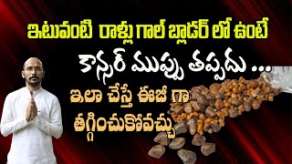 ఇటువంటి రాళ్లు గాల్ బ్లాడర్ లో ఉంటే కాన్సర్ ముప్పు తప్పదు   DrMadhu Babu Health Trends [upl. by Aileno302]