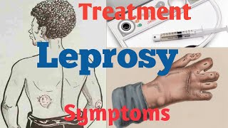 What is Leprosy  What causes Leprosy  Leprosy Diagnosis [upl. by Aihsenod394]