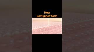 how the Lentiginesquot form on face Lentiginesquotblackness on the face [upl. by Junette]