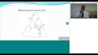 Diagnosis and Management of Coarctation of Aorta by Dr Suresh Kumar [upl. by Franklyn]