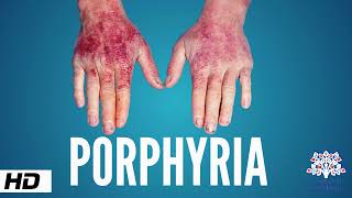 Porphyria Causes Signs and Symptoms Diagnosis and Treatment [upl. by Votaw862]