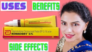 Kenacort 01 Gel  Kenacort Oral Paste Review  Abbott Kenacort  Kenacort Benefits and Side effects [upl. by Ainolopa]