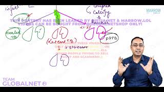 TB  EPIDEMIOLOGY AND DIAGNOSIS By Dr Mukhmohit singh sir Community medicine Marrow Video Lacture [upl. by Pacian847]