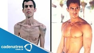 Bulimia y Anorexia un mal que afecta a hombres y mujeres [upl. by Willtrude]