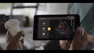 Philips Lumify  Ultrasound on your compatible smart device [upl. by Huntley]