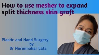 How to use mesher to expand split thickness skin graft [upl. by Henrion224]