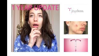 GIRL TALK 1 YEAR JAYDESS IUD UPDATE  QampA SIDE EFFECTS MY EXPERIENCE  EP 8  Athina Carolina [upl. by Adamik]