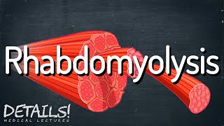 Rhabdomyolysis  Details [upl. by Gregrory]