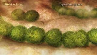 Immune System  Fighting Infection by Clonal Selection 2009 Etsuko Uno wehitv [upl. by Danika563]