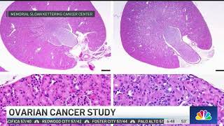 Nuclear Medicine Treatment Cures Lethal Form of Ovarian Cancer in Preclinical Setting [upl. by Netsrik909]