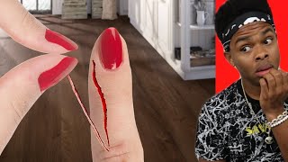 Painful Things And Tik Tok Pranks We Can All Relate To [upl. by Torray]