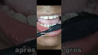 Comment se brosser les dents correctement [upl. by Amye]