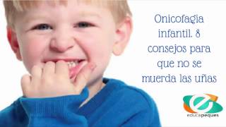 Onicofagia infantil 8 consejos para que no se muerda las uñas [upl. by Sedinoel214]