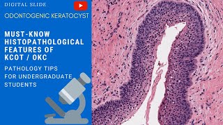 Odontogenic Keratocyst Histopathology [upl. by Ivanna]