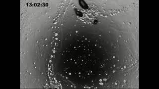 Dictyostelium discoideum developmentcombined videos from David Knecht and Rex Chisholm labs [upl. by Tychon]