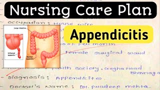 Nursing Care Plan on Appendicitis Nursing Diagnosis Nursing process [upl. by Whittemore]